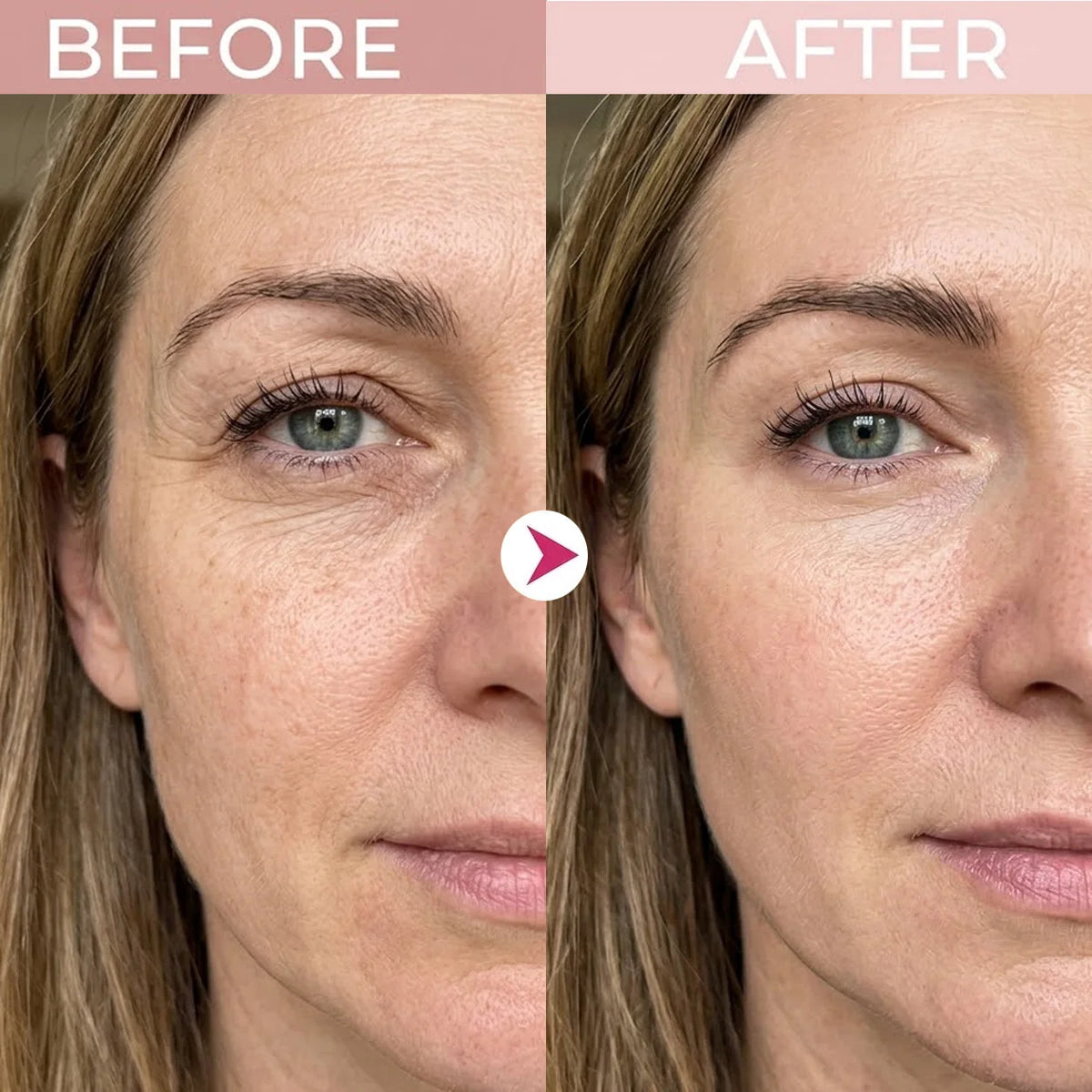 ✨ P7 Eye Renewal Crème™ – 3-in-1 Red Light & EMS Eye Treatment for Fine Lines, Puffiness & Dark Circles