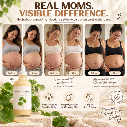 True Belly Serum – Pregnancy Belly Care for Hydration & Skin Elasticity, 4 FL OZ
