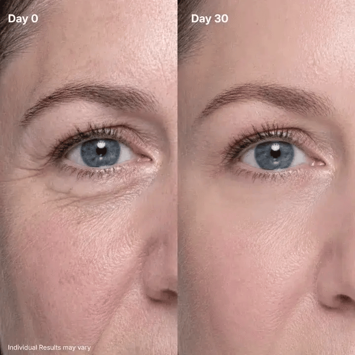 ✨ P7 Eye Renewal Crème™ – 3-in-1 Red Light & EMS Eye Treatment for Fine Lines, Puffiness & Dark Circles