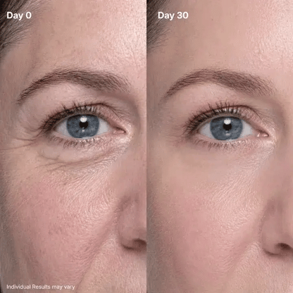 ✨ P7 Eye Renewal Crème™ – 3-in-1 Red Light & EMS Eye Treatment for Fine Lines, Puffiness & Dark Circles